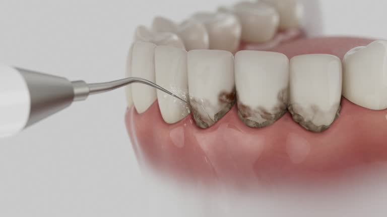 Reliable Tooth Extraction contractor in Dimondale, MI by Smile Center Dentistry